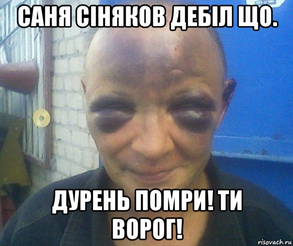 саня сiняков дебiл що. дурень помри! ти ворог!, Мем человек синяк