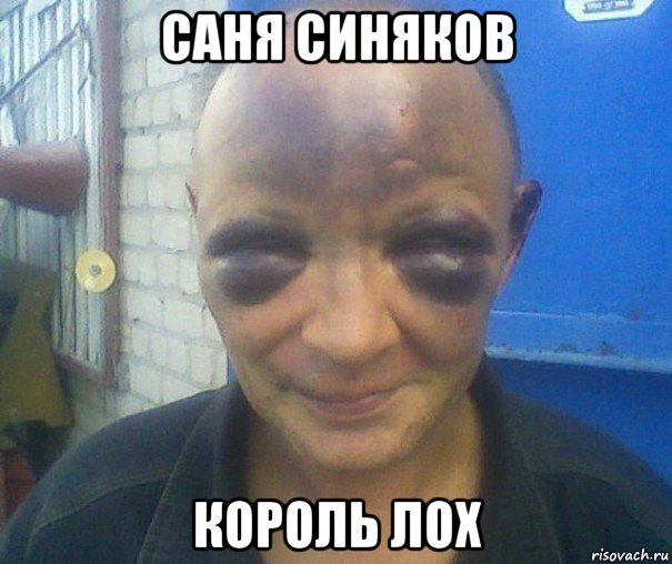саня синяков король лох