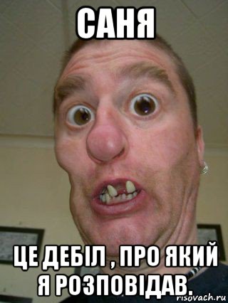 саня це дебіл , про який я розповідав.