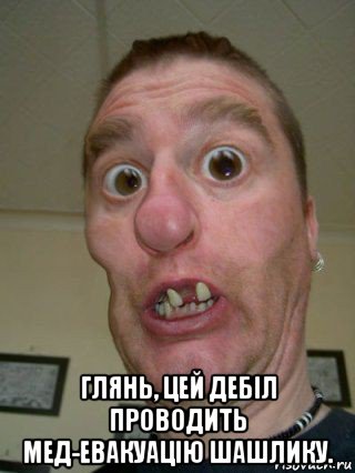  глянь, цей дебіл проводить мед-евакуацію шашлику.