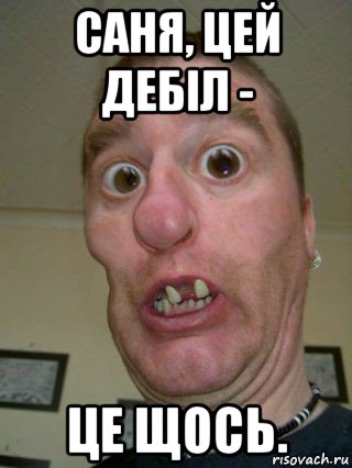 саня, цей дебіл - це щось.
