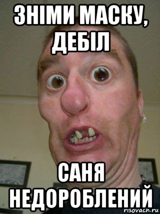 зніми маску, дебіл саня недороблений