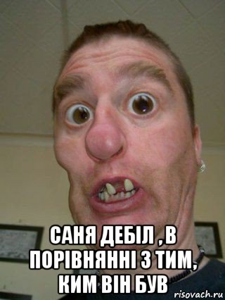  саня дебіл , в порівнянні з тим, ким він був