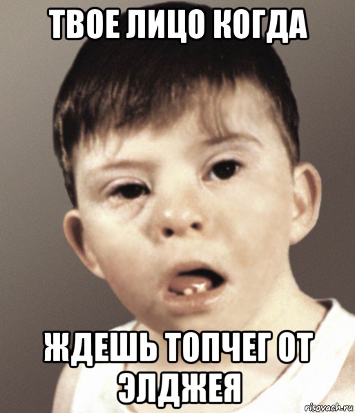 твое лицо когда ждешь топчег от элджея