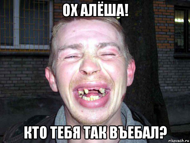 ох алёша! кто тебя так въебал?