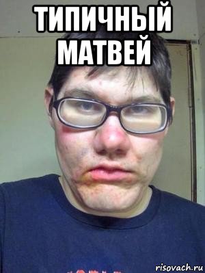 типичный матвей , Мем красавчик