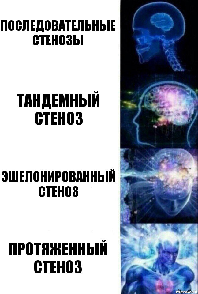 Последовательные стенозы Тандемный стеноз Эшелонированный стеноз Протяженный стеноз, Комикс  Сверхразум