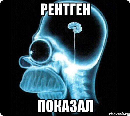 рентген показал