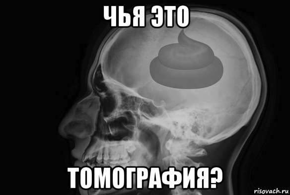 чья это томография?