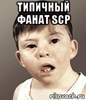 типичный фанат scp , Мем Даун