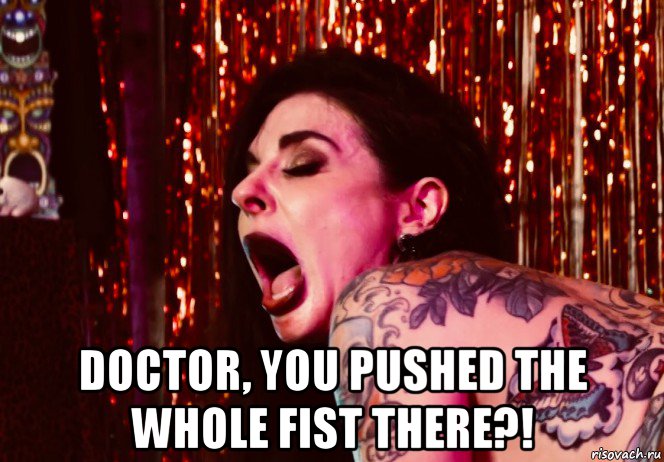 doctor, you pushed the whole fist there?!