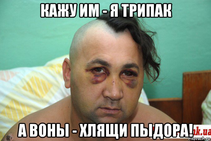кажу им - я трипак а воны - хлящи пыдора!