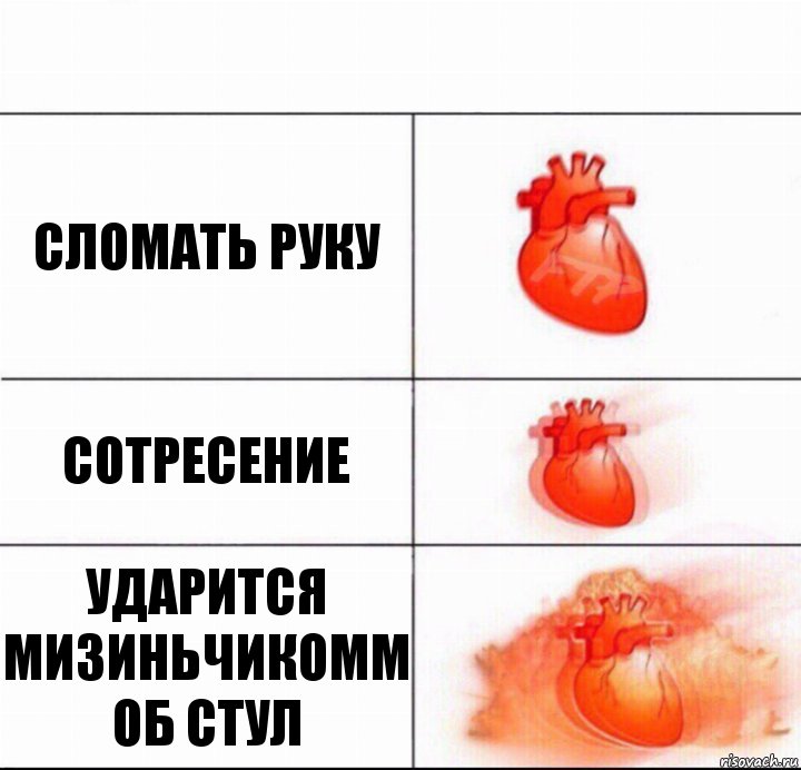 Сломать руку Сотресение Ударится мизиньчикомм об стул, Комикс  Расширяюшее сердце