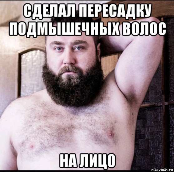 сделал пересадку подмышечных волос на лицо, Мем Юра