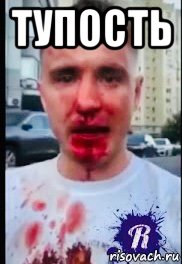 тупость , Мем Коваленко после драки с Чеченцами