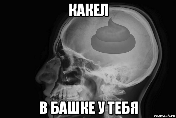 какел в башке у тебя