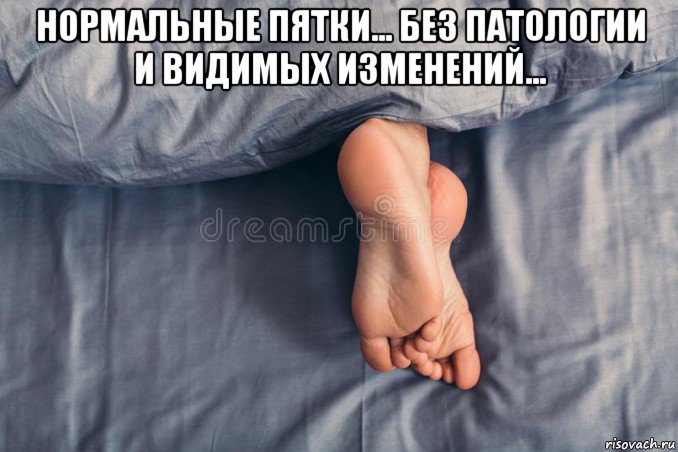нормальные пятки... без патологии и видимых изменений... , Мем Выходной