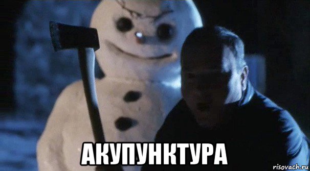  акупунктура