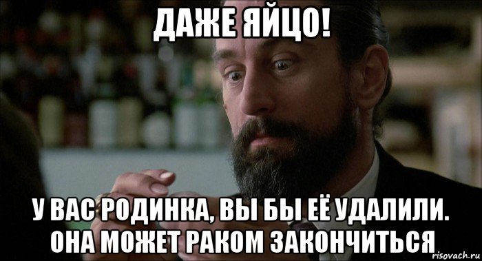 даже яйцо! у вас родинка, вы бы её удалили. она может раком закончиться, Мем Robert De Niro