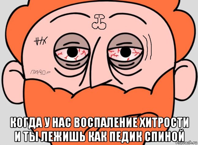  когда у нас воспаление хитрости и ты лежишь как педик спиной, Мем Ричерд встал в 3 часа ночи