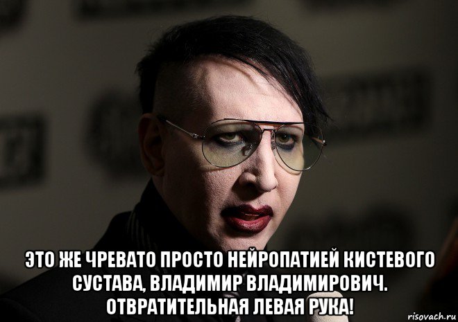  это же чревато просто нейропатией кистевого сустава, владимир владимирович. отвратительная левая рука!