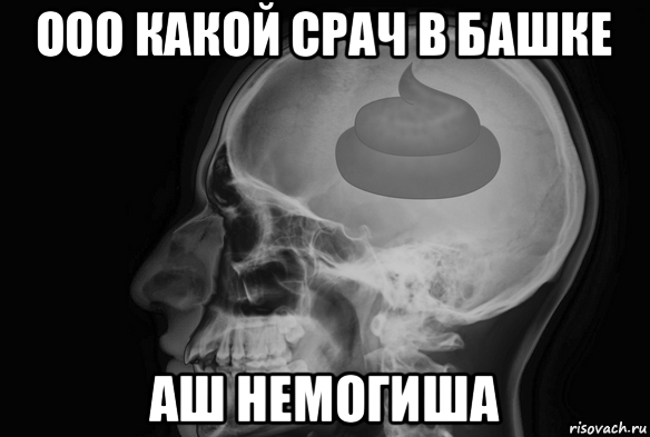 ооо какой срач в башке аш немогиша