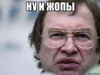 ну и жопы 