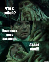 что с тобой? Козявка в носу застряла. Ах,вот она!!!