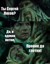 Ты Сергей Ляхов? Да, я админ нотки. Проник до глотки!