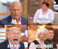 Я лысыи? Да Хуи На! Пиздобол)