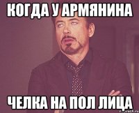 когда у армянина челка на пол лица