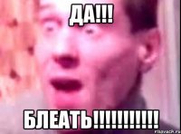 ДА!!! блеать!!!!!!!!!!!