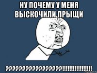 Ну почему у меня выскочили прыщи ?????????????????!!!!!!!!!!!!!!!!!