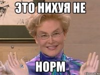 это нихуя не норм