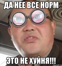 Да нее все норм Это не хуйня!!!