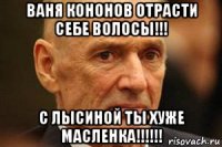 ваня кононов отрасти себе волосы!!! с лысиной ты хуже масленка!!!!!!