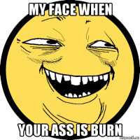 my face when your ass is burn