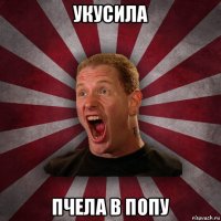 укусила пчела в попу