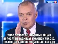  у нас, зачастую, небритые яйца и волосатые задницы в каждому видео. но это еще больше возбуждает кого-то