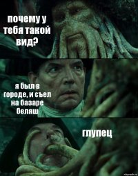 почему у тебя такой вид? я был в городе, и съел на базаре беляш глупец