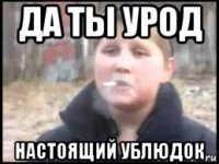 да ты урод настоящий ублюдок