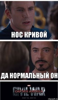 Нос кривой Да нормальный он