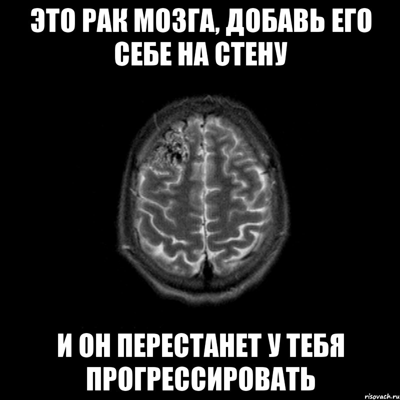 Почему без мозгов. Мемы про мозги. Нету мозга.