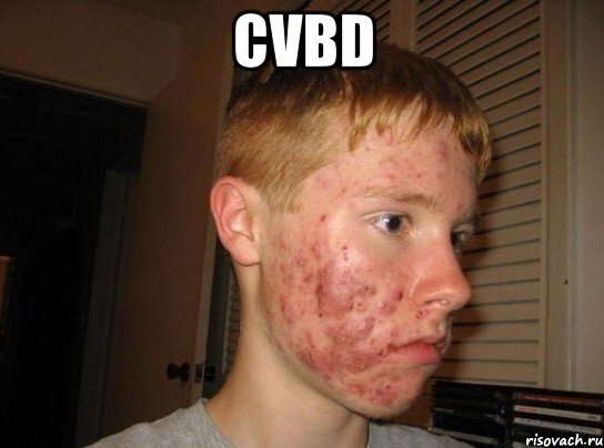 cvbd , Мем ШТО