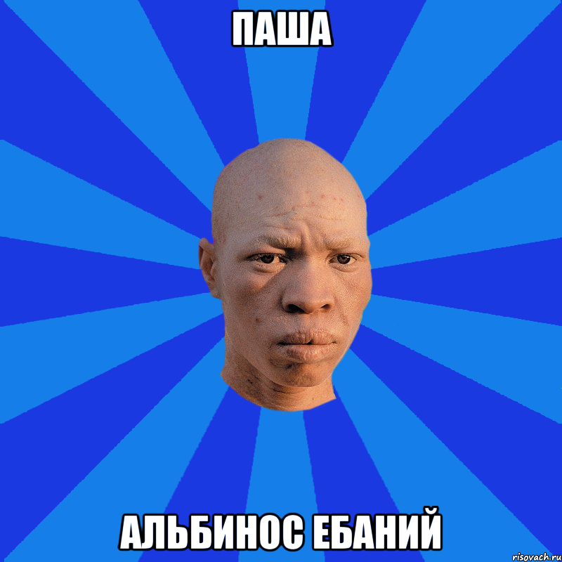 Паша АЛЬБИНОС ЕБАНИЙ