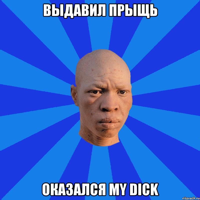 выдавил прыщь оказался my dick, Мем НЕДОВОЛЬНЫЙ АЛЬБИНОС