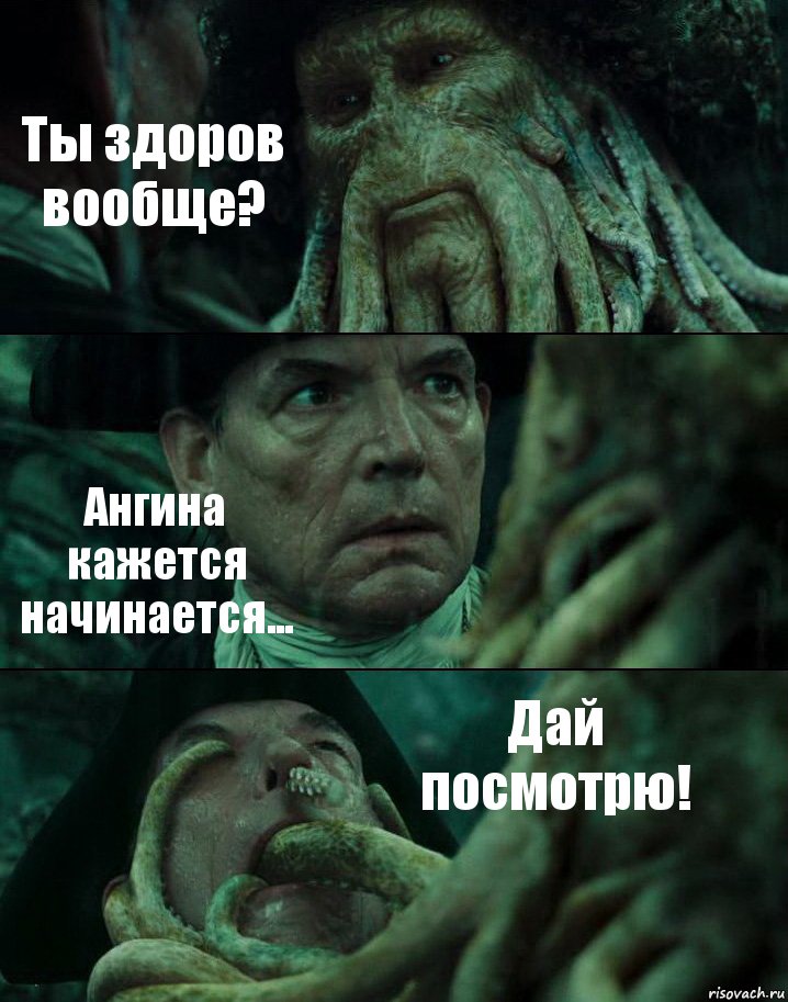 Ты здоров вообще? Ангина кажется начинается... Дай посмотрю!, Комикс Пираты Карибского моря