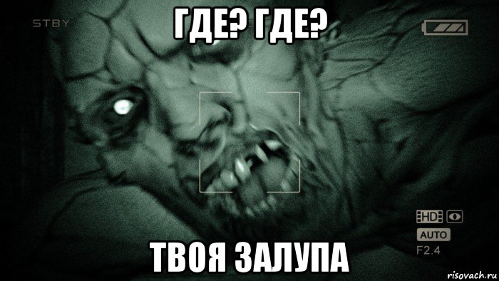 где? где? твоя залупа