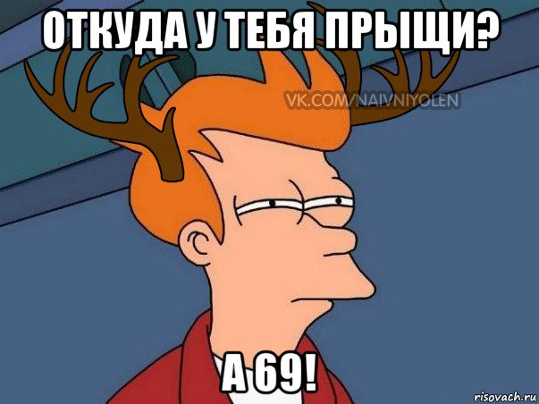 откуда у тебя прыщи? а 69!