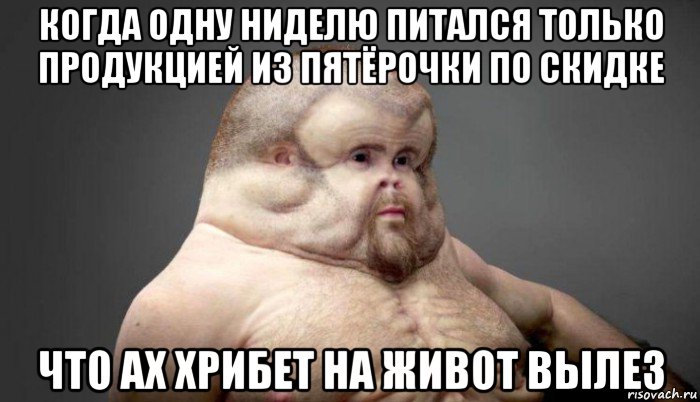 когда одну ниделю питался только продукцией из пятёрочки по скидке что ах хрибет на живот вылез, Мем  Человек который выживет в лбом ДТП